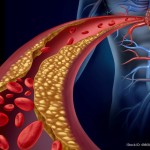 Polypharma marks World Cholesterol Day