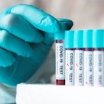 ZELLX® COVID-19 Coronavirus assays