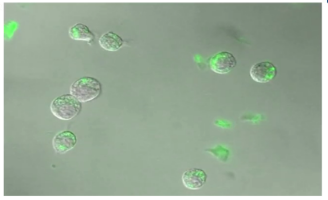 Fluorescently Labeled Peptides and Amino Acids – Amyloid Beta 1-42