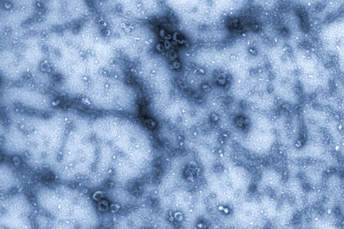 47963Evercyte off-the-shelf extracellular vesicles (EVs)